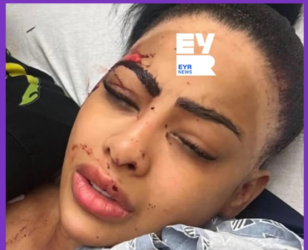 Circula imagen de Yailin La Más Viral herida en un hospital ¿Qué le pasó?